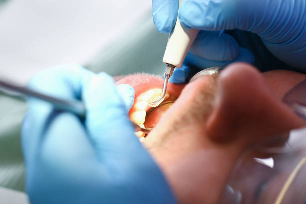 Best Pediatric Emergency Dentist in Claremont, CA