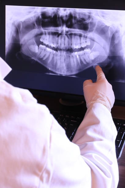 Best Emergency Dental Care for Broken or Chipped Teeth in Claremont, CA