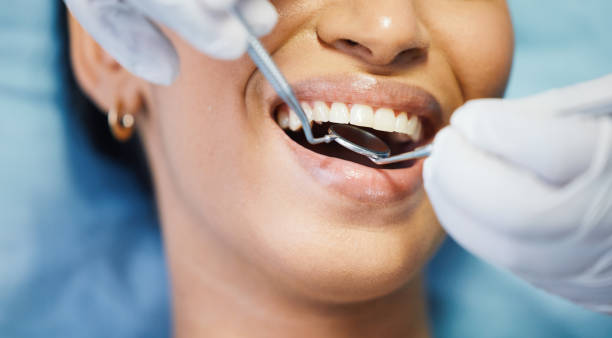 Best Cosmetic Emergency Dentistry in Claremont, CA