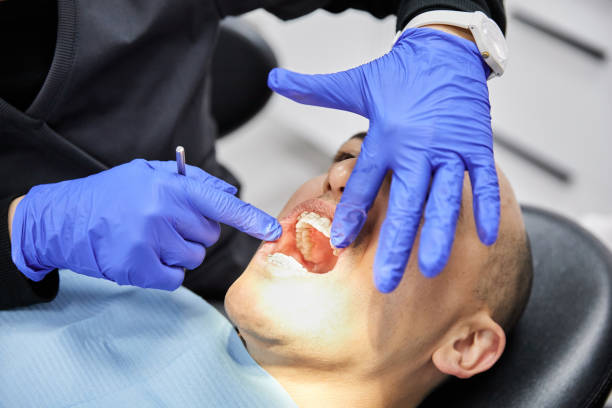 Best Emergency Treatment for Dental Infections or Abscesses in Claremont, CA
